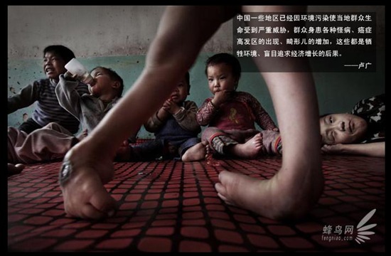 Bambini-cinesi-deformi-causa-elevato-inquinamento